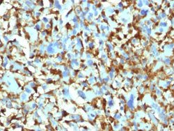 F13A1 Mouse anti-Human, Clone: F13A1/1448, Abnova 100ug:Antibodies, Monoclonal