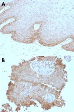 FAT2 Mouse anti-Human, Clone: 8C5, Abnova 100 &mu;g | Buy Online | Abnova Corporation | Fisher Scientific