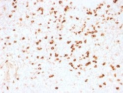 Lambda Light Chain Mouse anti-Human, Clone: N10/2, Abnova 100ug:Antibodies,