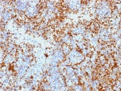 ITGB3 Mouse anti-Human, Clone: Y2/51, Abnova 100ug:Antibodies, Monoclonal