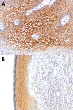 JUP Mouse anti-Human, Clone: CTNG/1483, Abnova 100 &mu;g | Buy Online | Abnova Corporation | Fisher Scientific