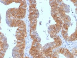 EPCAM Mouse anti-Human, Clone: EGP40/1384, Abnova™