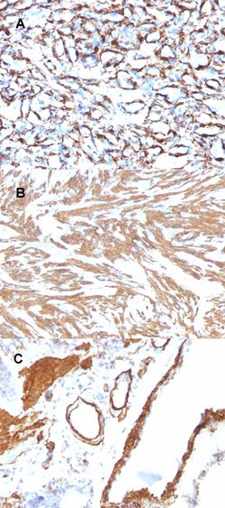 ACTA2 Mouse anti-Human, Rat, Clone: ACTA2/791, Abnova 100ug:Antibodies,