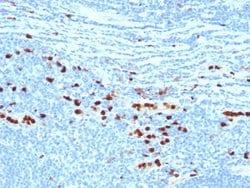 Macrophage Mouse anti-Human, Clone: MAC387, Abnova 100ug:Antibodies, Monoclonal