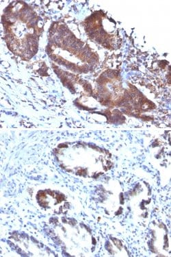 TAGLN Mouse anti-Human, Clone: TAGLN/247, Abnova 100 &mu;g | Buy Online | Abnova | Fisher Scientific