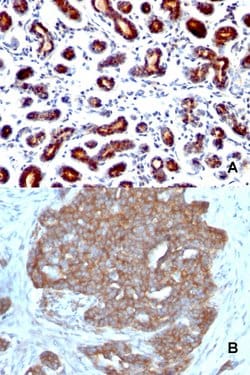 TFF1 Mouse anti-Human, Clone: TFF1/1091, Abnova 100 &mu;g | Buy Online | Abnova | Fisher Scientific