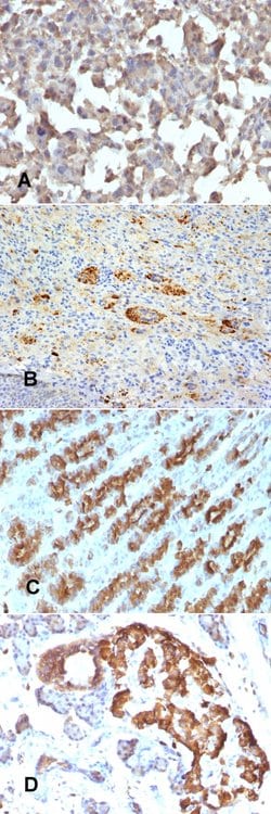 TNF Mouse anti-Human, Rat, Clone: TNFA/1172, Abnova 100 &mu;g | Buy Online | Abnova | Fisher Scientific