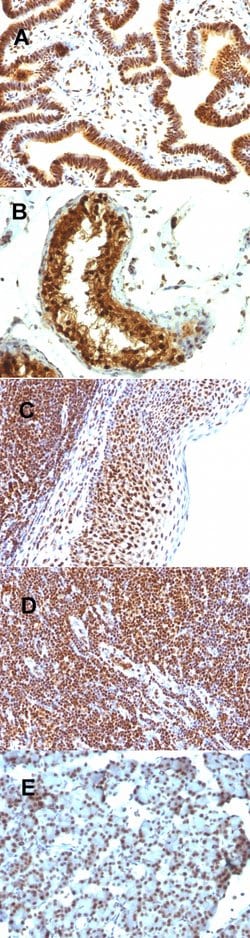 SUMO1 Mouse anti-Human, Rat, Clone: SUMO1/1188, Abnova 100 &mu;g | Buy Online | Abnova | Fisher Scientific