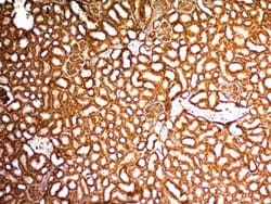 WT1 Mouse anti-Human, Mouse, Rat, Clone: WT1/857, Abnova 100ug:Antibodies,