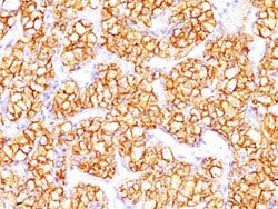 CA9 Mouse anti-Human, Clone: PN-15, Abnova 100 &mu;g | Buy Online | Abnova Corporation | Fisher Scientific