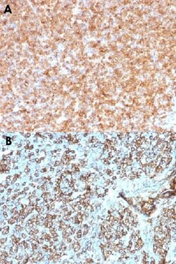 HLA-DP/HLA-DQ/HLA-DR Mouse anti-Human, Clone: CR3/43, Abnova 100ug:Antibodies,