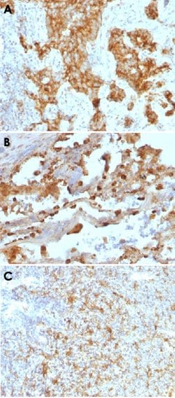 ITGAX Mouse anti-Human, Clone: ITGAX/1243, Abnova 100ug:Antibodies, Monoclonal