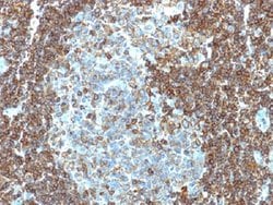 CD3E Mouse anti-Human, Clone: PC3/188A, Abnova 100ug:Antibodies, Monoclonal