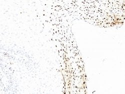 Human papilloma virus 16 Mouse, Clone: CAMVIR-1, Abnova 100ug:Antibodies,