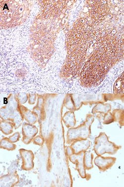 EGFR Mouse anti-Human, Clone: GFR/1667, Abnova 100ug:Antibodies, Monoclonal