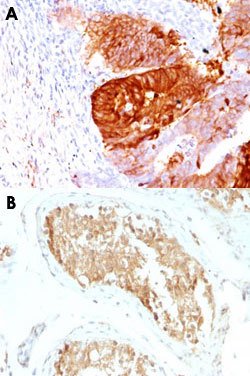 ALDH1A1 Mouse anti-Human, Clone: ALDH1A1/1381, Abnova 100ug:Antibodies,