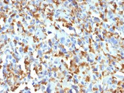 F13A1 Mouse anti-Human, Clone: F13A1/1683, Abnova 100ug:Antibodies, Monoclonal