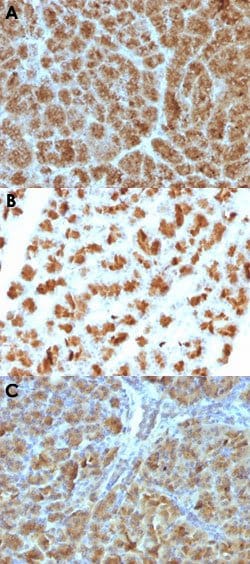 ELA3B Mouse anti-Human, Mouse, Rat, Clone: CELA3B/1257, Abnova 100ug:Antibodies,
