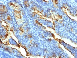 FSHR Mouse anti-Human, Clone: FSHR/1400, Abnova 100ug:Antibodies, Monoclonal