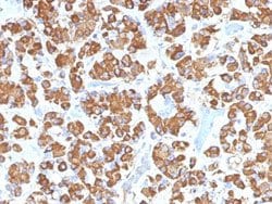 GH1 Mouse anti-Human, Clone: GH/1450, Abnova 100ug:Antibodies, Monoclonal