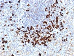 Lambda Light Chain Mouse anti-Human, Clone: LLC/1738, Abnova 100ug:Antibodies,