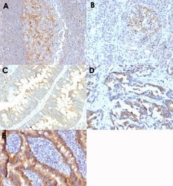 ABCC1 Mouse anti-Human, Clone: MRP1/1343, Abnova 100ug:Antibodies, Monoclonal