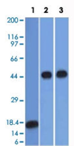 SERPINA1 Mouse anti-Human, Clone: AAT/1378, Abnova 100 &mu;g | Buy Online | Abnova Corporation | Fisher Scientific