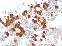 POMC Mouse anti-Human, Clone: CLIP/1407, Abnova 100ug:Antibodies, Monoclonal