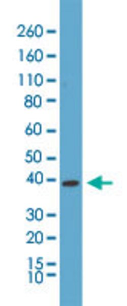p38 MAPK Rabbit anti-Human, Clone: RM245, Abnova 100uL:Antibodies, Monoclonal