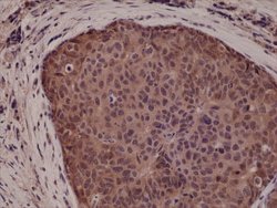 p38 MAPK Rabbit anti-Human, Clone: RM245, Abnova 100uL:Antibodies, Monoclonal