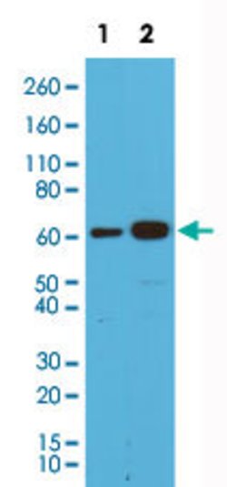 SMAD4 Rabbit anti-Human, Clone: RM277, Abnova 100uL:Antibodies, Monoclonal