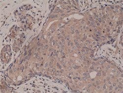 SMAD4 Rabbit anti-Human, Clone: RM277, Abnova 100uL:Antibodies, Monoclonal