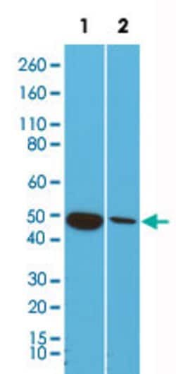 KRT18 Rabbit anti-Human, Clone: RM279, Abnova 100uL:Antibodies, Monoclonal