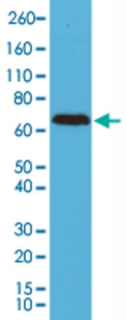 NEFL Rabbit anti-Human, Clone: RM280, Abnova 100uL:Antibodies, Monoclonal