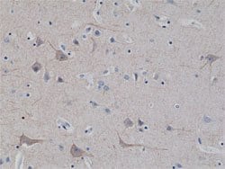 NEFL Rabbit anti-Human, Clone: RM280, Abnova 100uL:Antibodies, Monoclonal