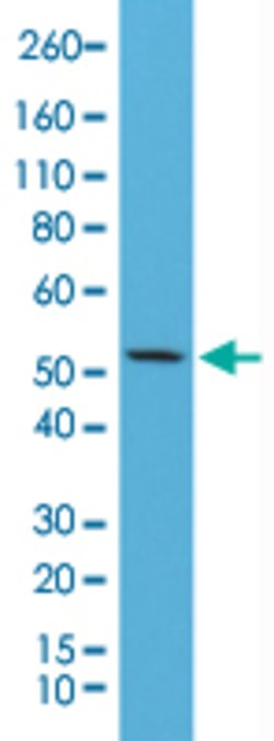 KRT7 Rabbit anti-Human, Clone: RM284, Abnova 100uL:Antibodies, Monoclonal
