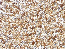 SPTBN2 Mouse anti-Human, Clone: SPTBN2/1582, Abnova 100ug:Antibodies, Monoclonal