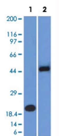 PAX8 Mouse anti-Human, Clone: PAX8/1492, Abnova 100ug:Antibodies, Monoclonal