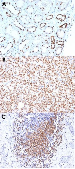PAX8 Mouse anti-Human, Clone: PAX8/1492, Abnova 100ug:Antibodies, Monoclonal