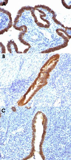 ASRGL1 Mouse anti-Human, Clone: CRASH/1289, Abnova 100ug:Antibodies, Monoclonal