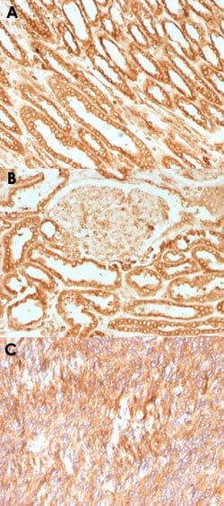 CANX Mouse anti-Human, Clone: CANX/1541, Abnova 100 &mu;g | Buy Online | Abnova | Fisher Scientific