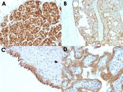 MAML2 Mouse anti-Human, Clone: MAML2/1302, Abnova 100ug:Antibodies, Monoclonal