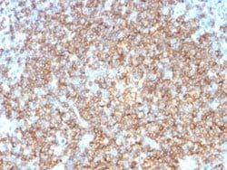 CD22 Mouse anti-Human, Clone: BLCAM/1795, Abnova 100ug:Antibodies, Monoclonal
