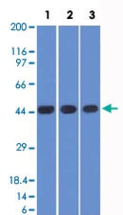 NAPSA Mouse anti-Human, Clone: NAPSA/1238 + NAPSA/1239, Abnova 100ug:Antibodies,