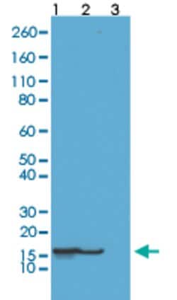 Histone H2B (acetyl K23) Rabbit anti-Human, Clone: RM260, Abnova 100ug:Antibodies,