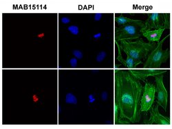 Histone H2B (phospho S14) Rabbit anti-Human, Clone: RM238, Abnova 100ug:Antibodies,