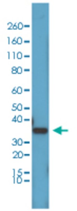 CCND1 Rabbit anti-Human, Clone: RM241, Abnova 100 &mu;L | Buy Online | Abnova Corporation | Fisher Scientific