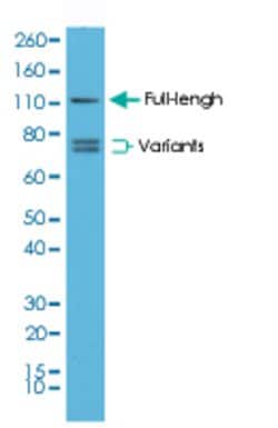 AR Rabbit anti-Human, Clone: RM254, Abnova 100uL:Antibodies, Monoclonal