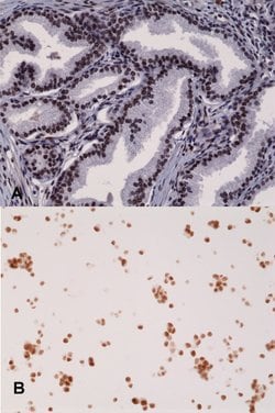 AR Rabbit anti-Human, Clone: RM254, Abnova 100uL:Antibodies, Monoclonal