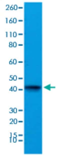 ACTC1 Rabbit anti-Human, Mouse, Clone: RM257, Abnova 100uL:Antibodies,